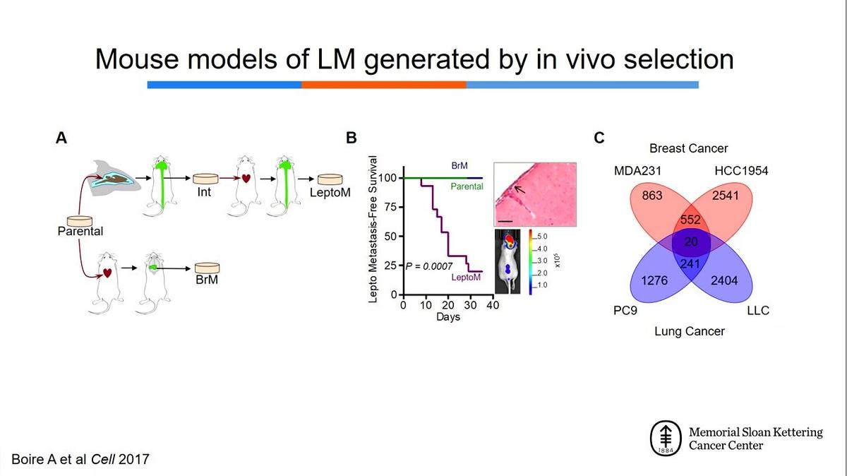Microenvironmental dynamics in leptomeningeal metastasis, Adrienne Boire