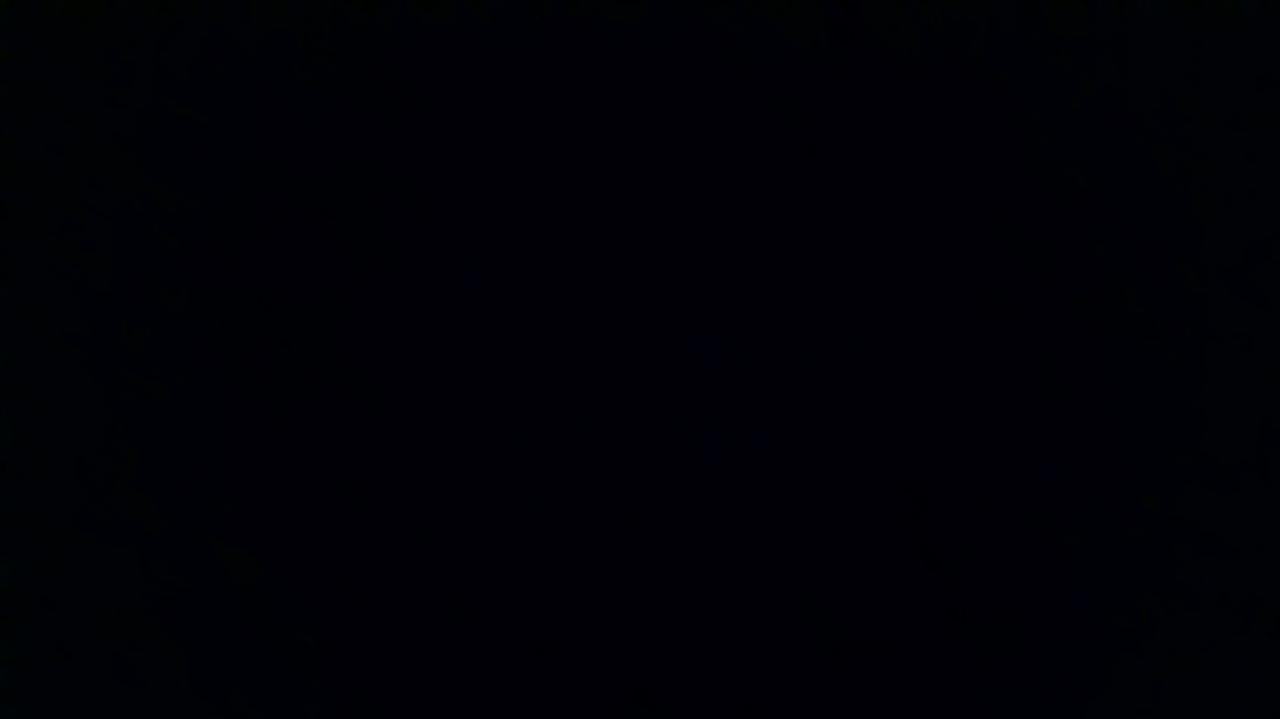 How was your post operative experience?