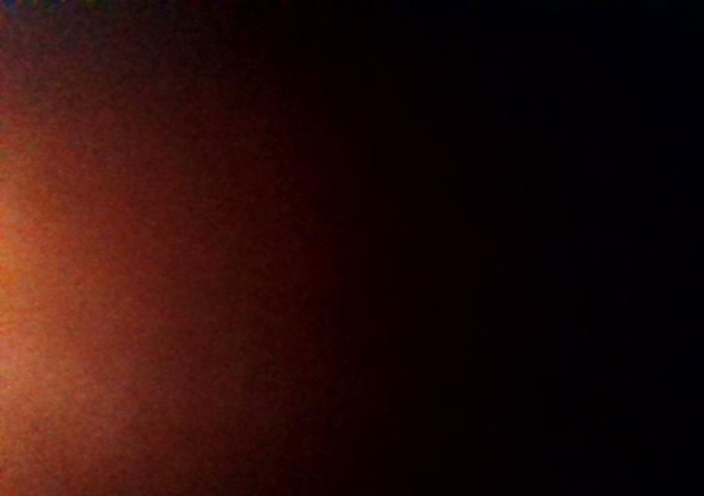 How was your post operative experience?