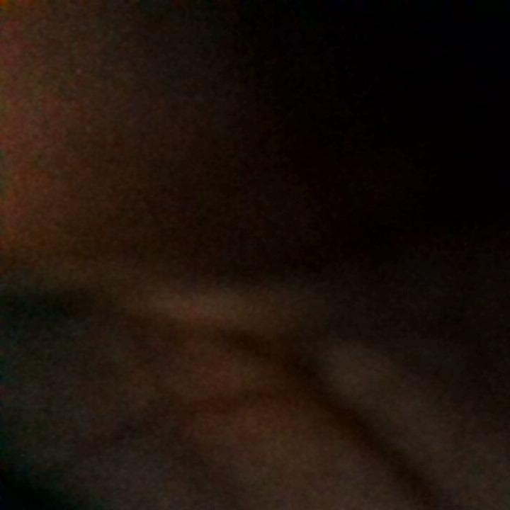 How was your post operative experience