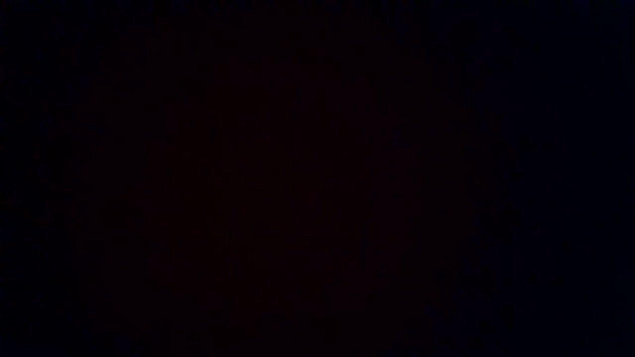 How was your post operative experience?