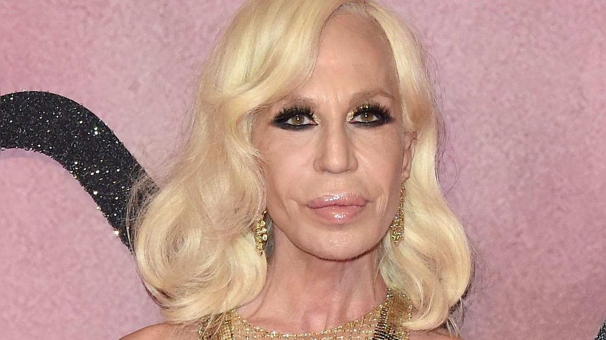 Botox und Co. haben diese Stars entstellt
