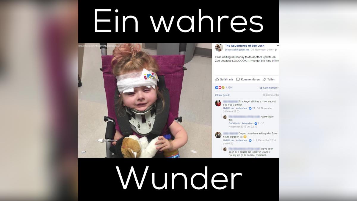 Ärzte gaben diesem Mädchen keine Überlebenschance, so sieht sie heute aus 1:1