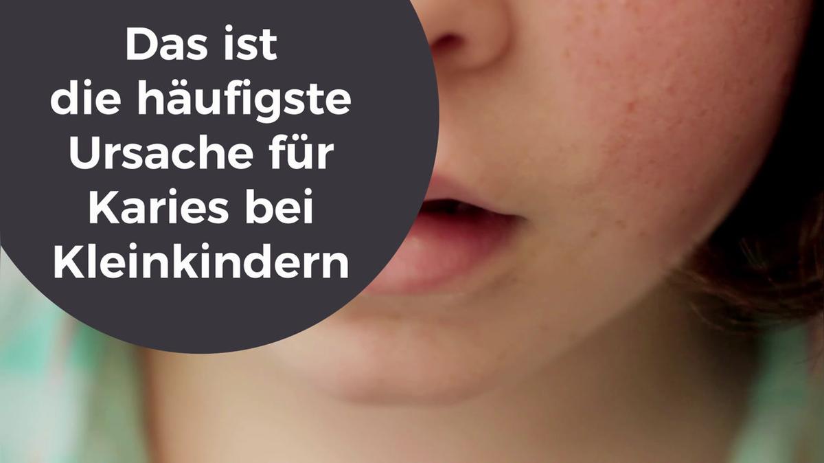 Das ist die häufigste Ursache für Karies bei Kleinkindern
