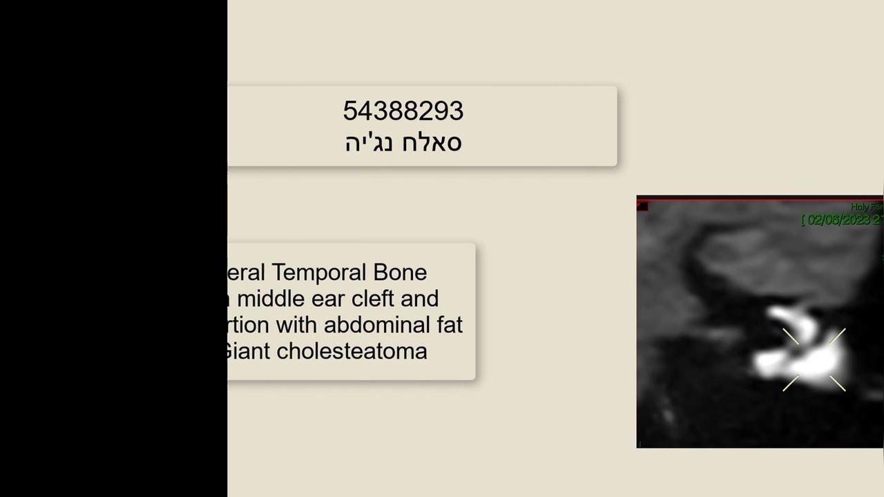 סרטון משפור