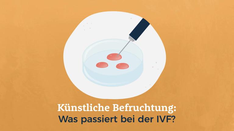 Künstliche Befruchtung: Was passiert bei der IVF?