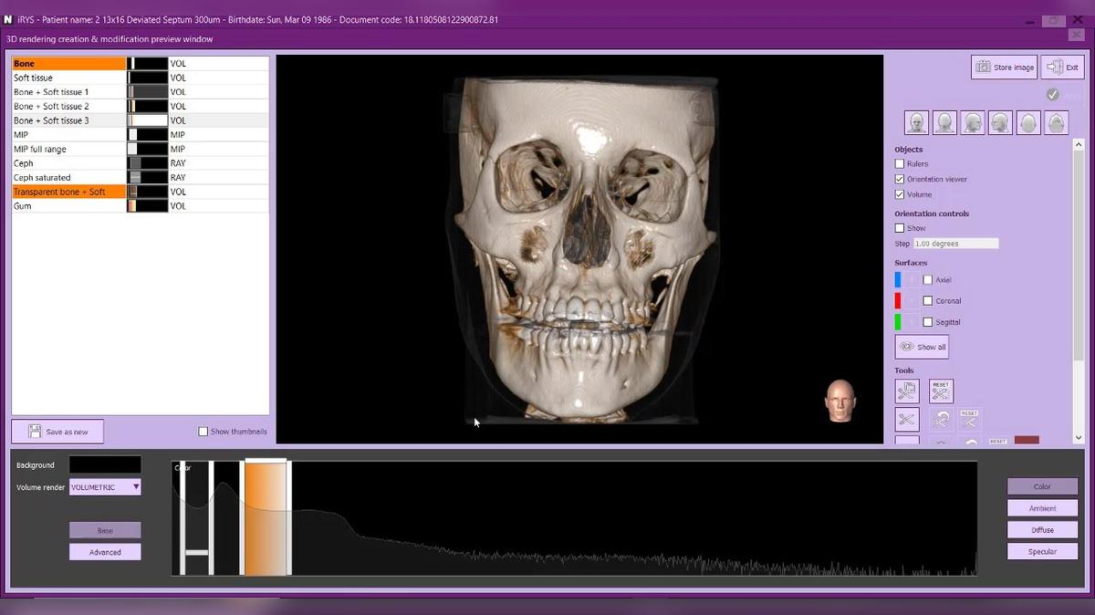 iRYS 11 - 3D Rendering