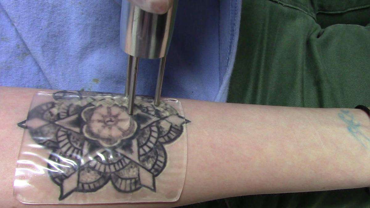 DESCRIBE® PFD Patches (Perfluorodecalin) - Treatment