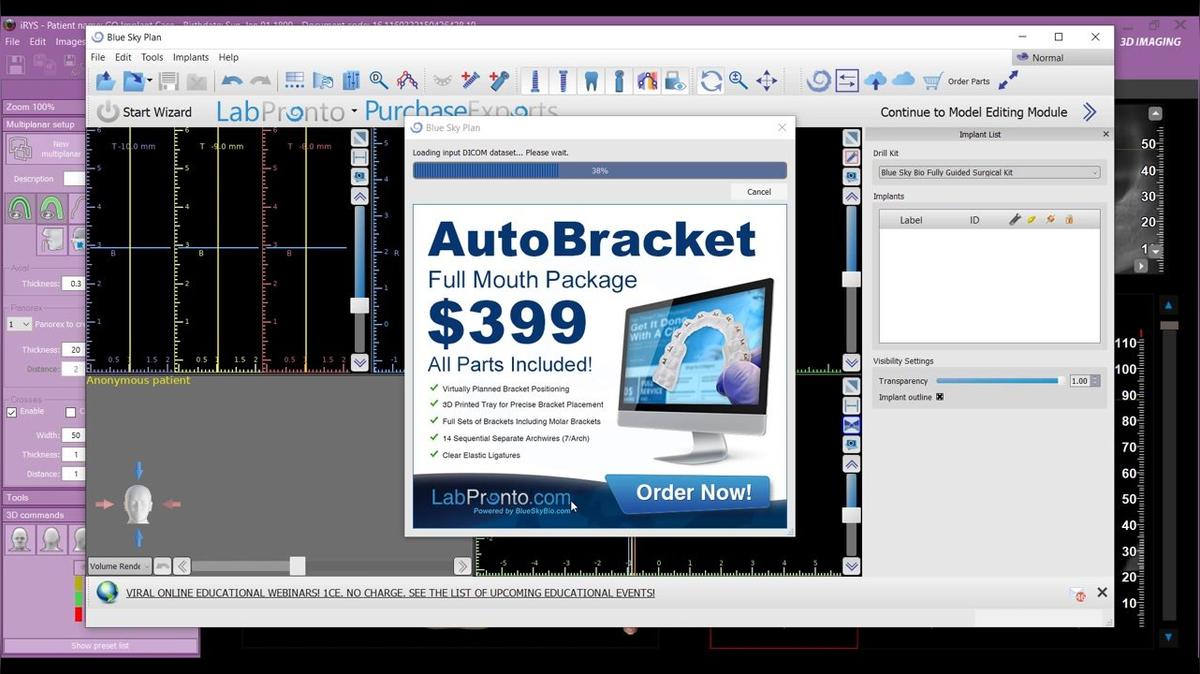 iRYS 11 - One-Click Blue Sky Integration