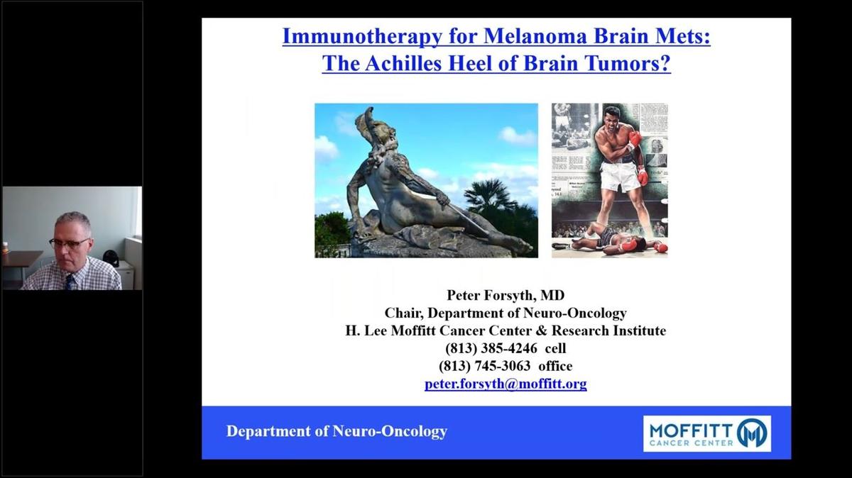 SNO Learning Center_ Brain Metastases from Melanoma.mp4