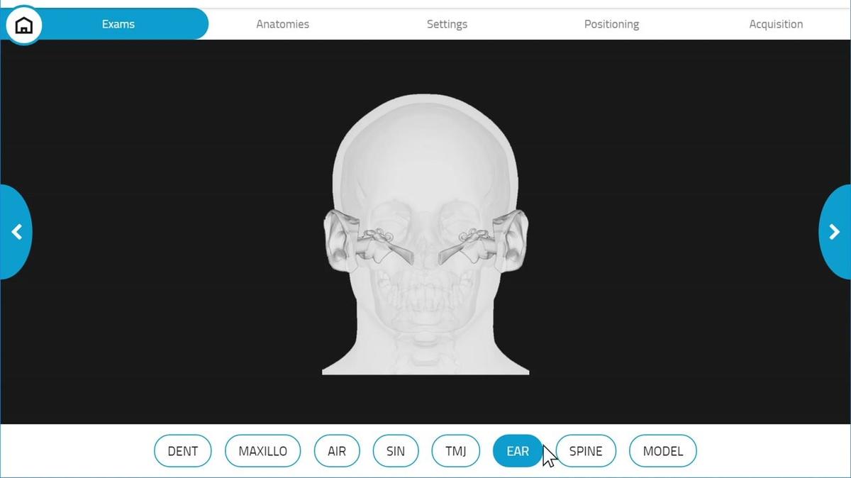 GiANO HR 3D Temporal Bone Acquisition