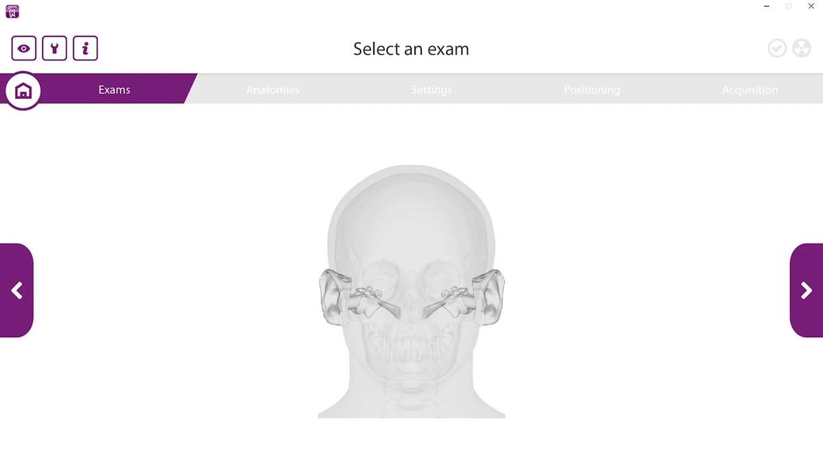 Hyperion X9 PRO 3D Temporal Bone Scan