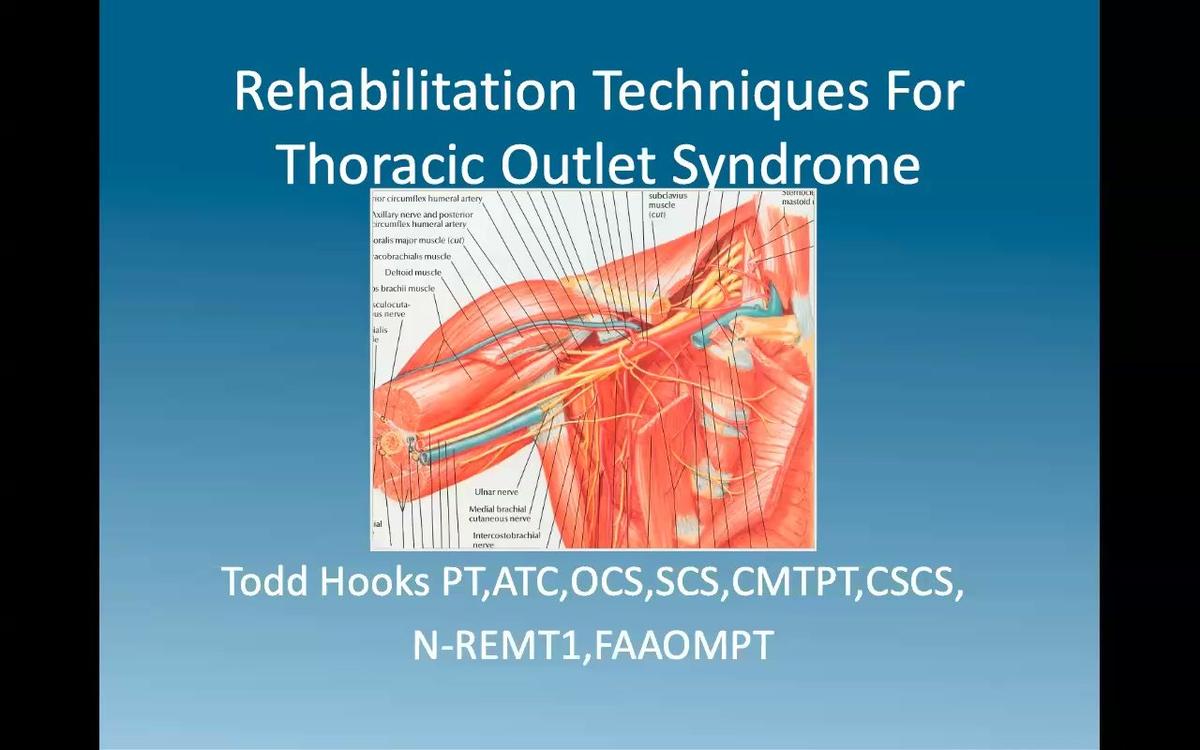 Rehab of Thoracic Outlet Syndrome