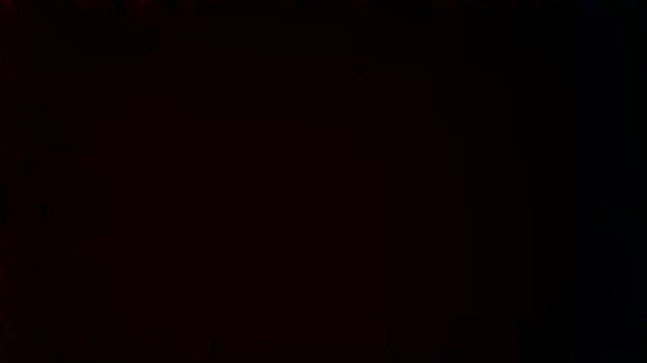 How was your post operative experience?