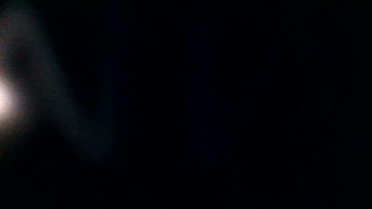 How was your post operative experience