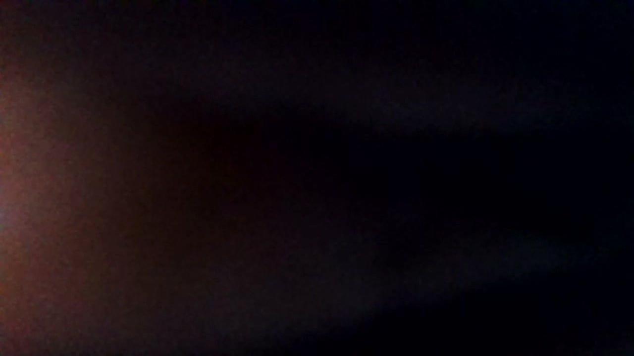 How was your post operative experience