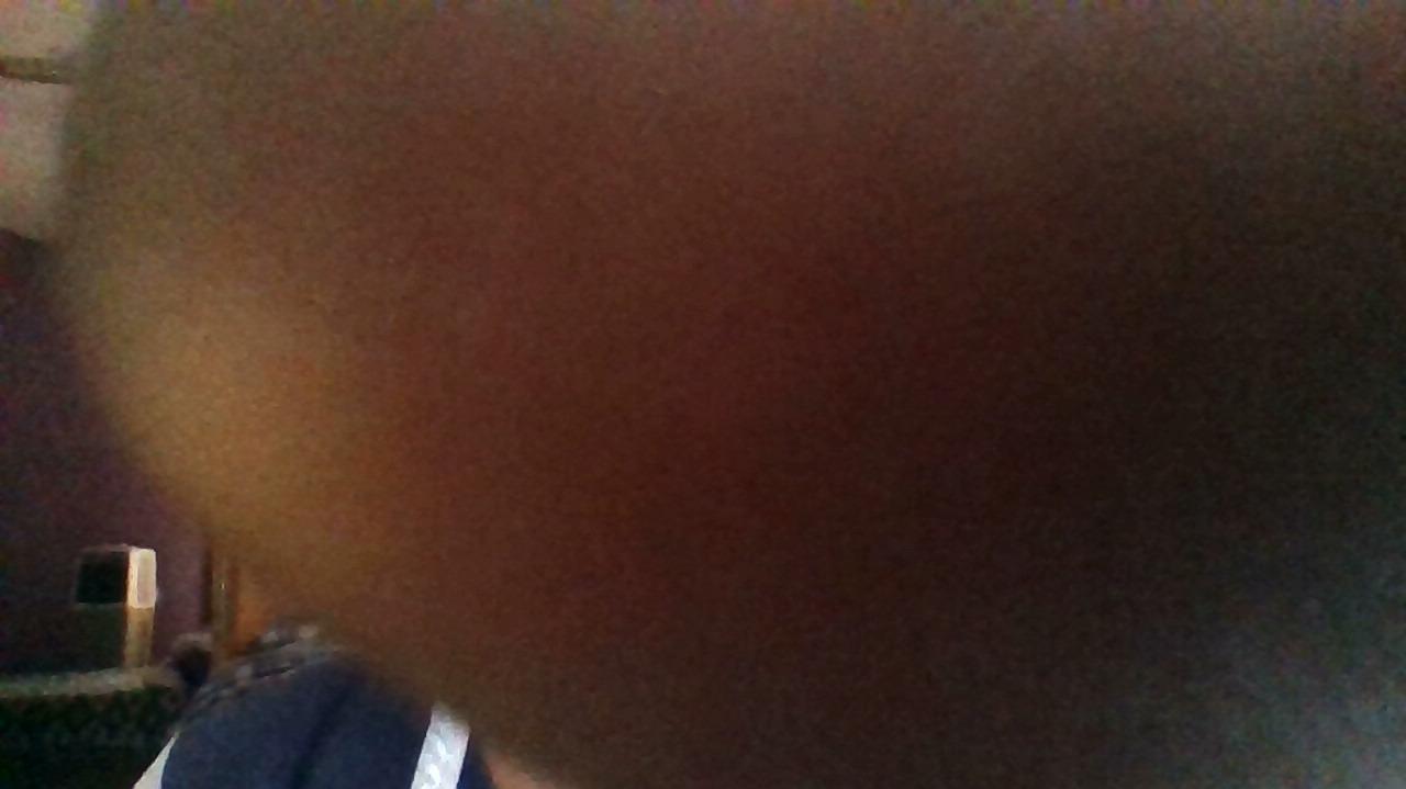 How was your post operative experience?